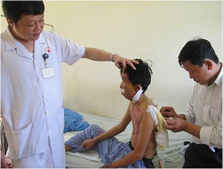 Tái tạo lại cả khuôn mặt bằng vạt da tự thân